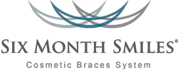 Six Month Smiles Braces
